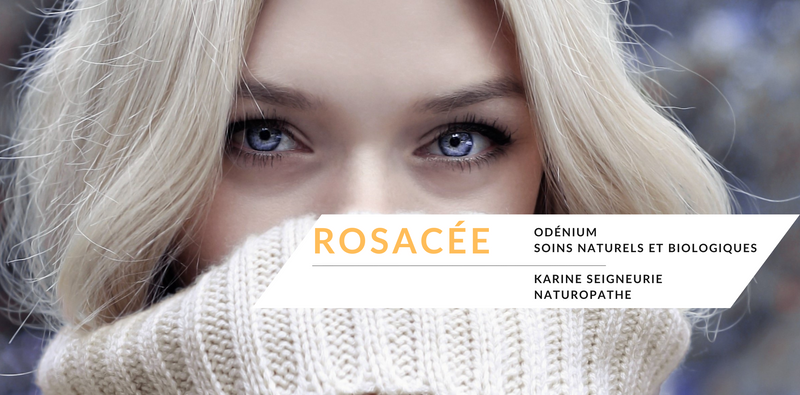 COMMENT PRENDRE SOIN DES PEAUX SUJETTES À LA ROSACÉE DURANT L’HIVER?